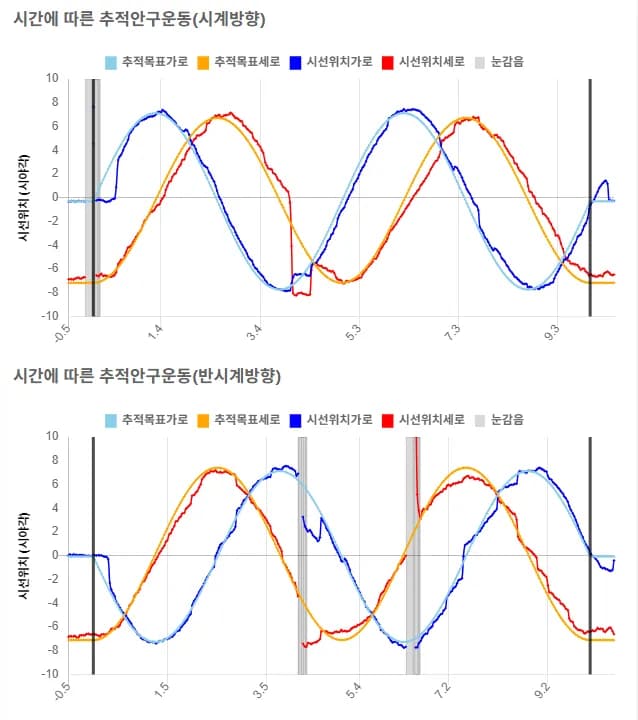 추적안구운동 검사